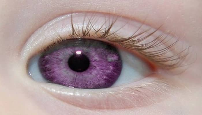 5 mais raras e exóticas cores de olhos que existem