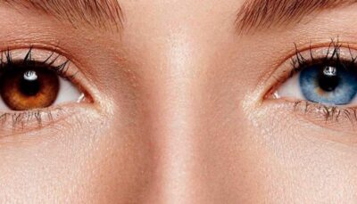 Cores De Olhos Mais Raras E Ex Ticas Do Mundo