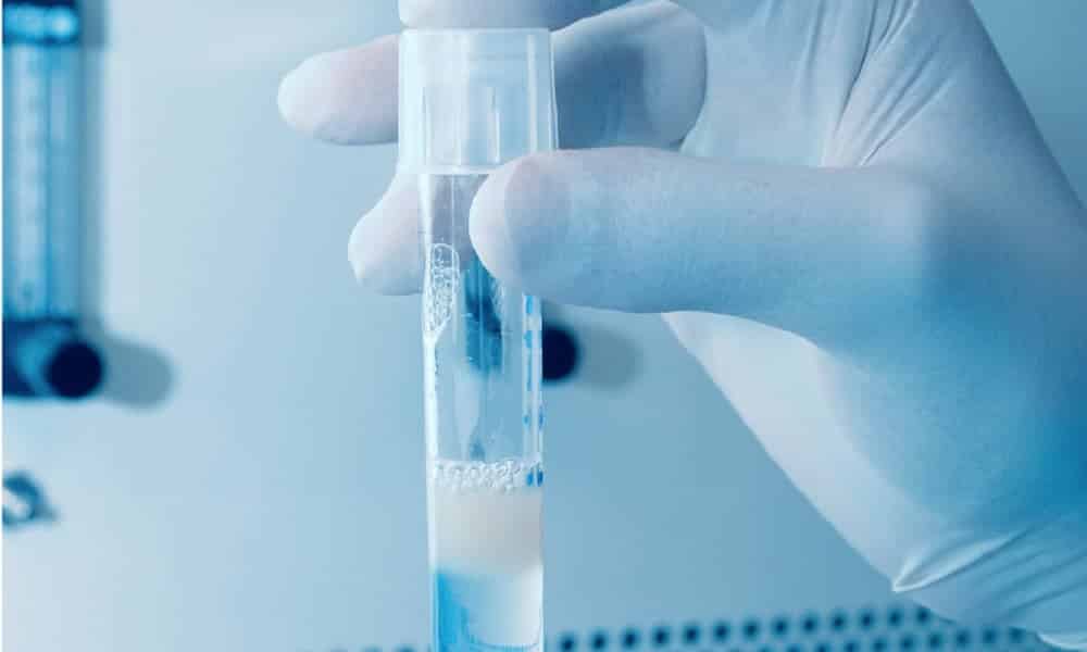 Cientistas criam espermatozoide em laboratório, a partir de célula feminina