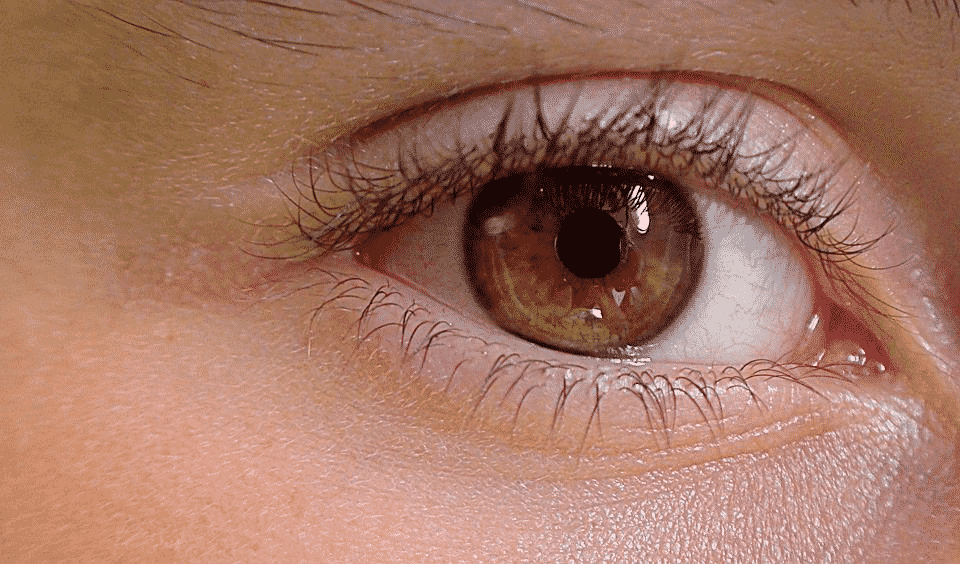 7 alimentos que mudam a cor dos olhos naturalmente