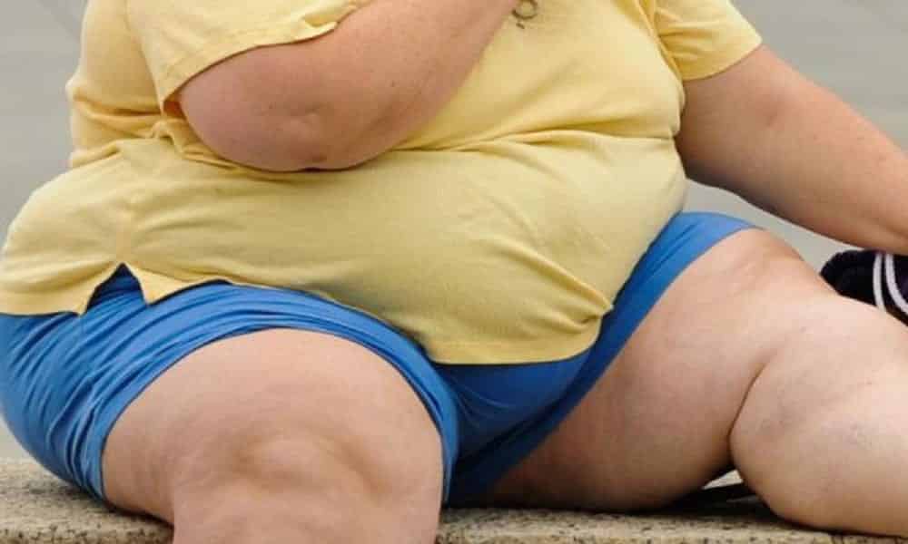 9 coisas que você precisa saber sobre a obesidade