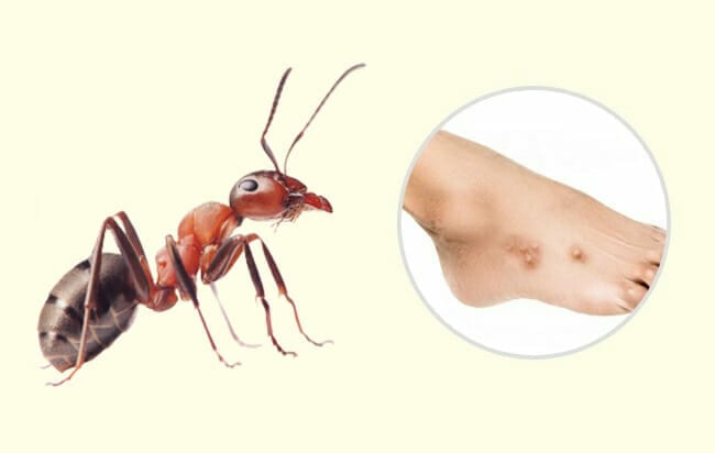 7 tipos de picadas de inseto que você precisa aprender a diferenciar