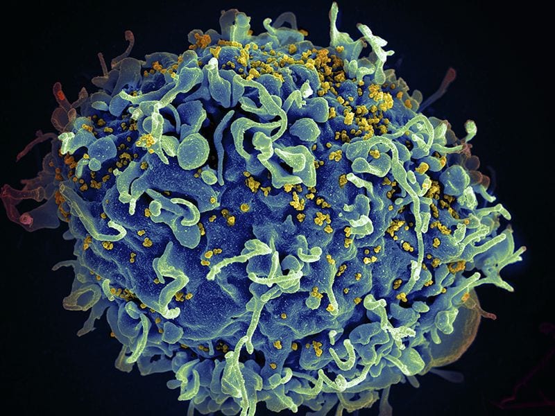Médicos anunciam que três pessoas já foram curadas do HIV