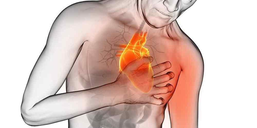 O que é o ataque cardíaco e o que fazer quando ocorrer?