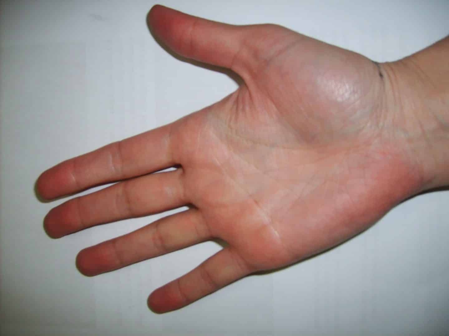 7 coisas que as suas mão revelam sobre a sua saúde