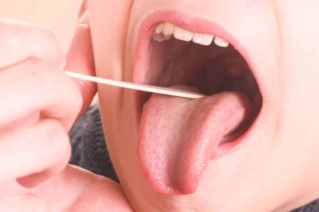 Entenda quais são as causas da dor de gargante e como tratá-la