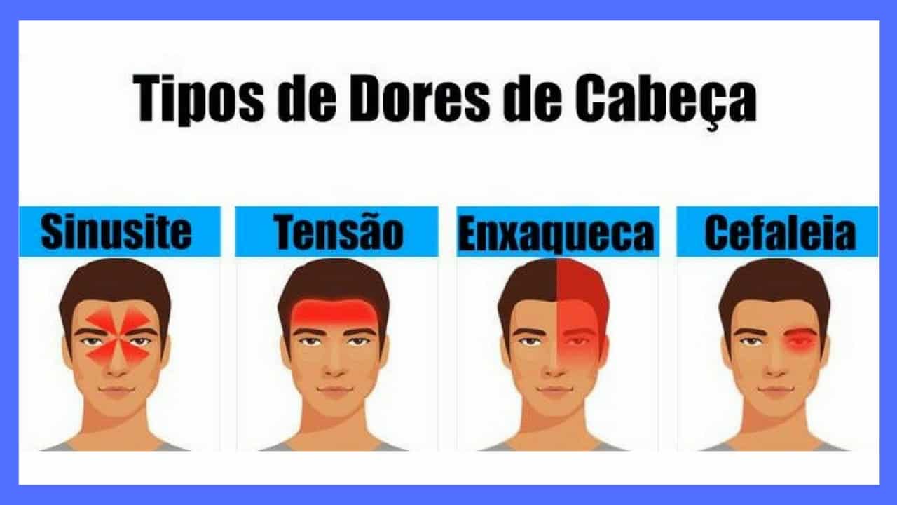 Tipos de Dores de Cabeça e suas causas