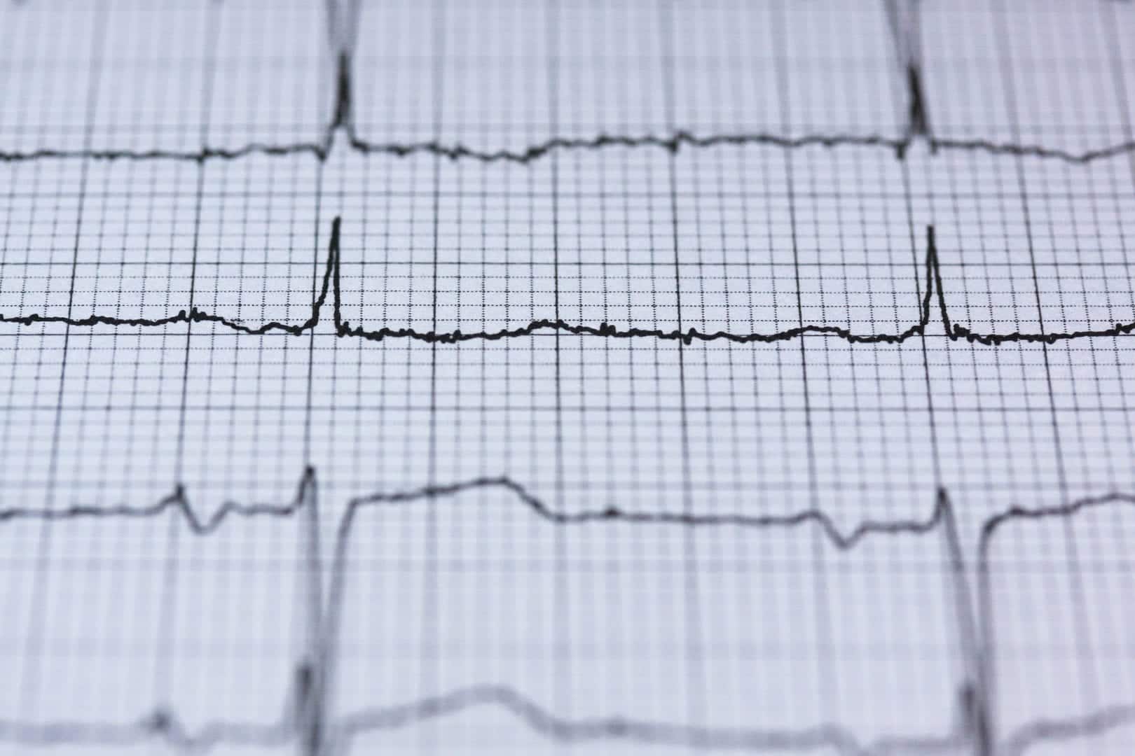 Cardiologista: Quando consultar?
