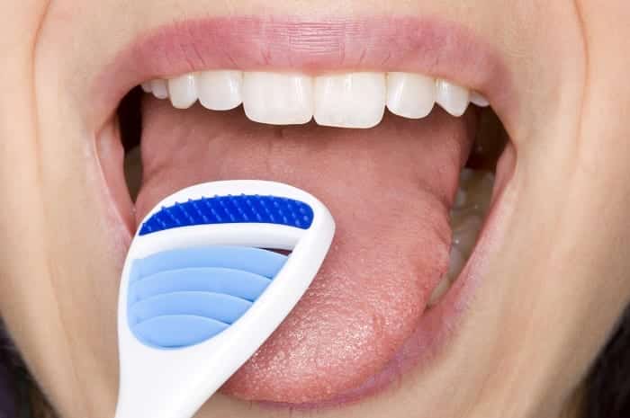 Saburra Lingual - o que é e como acabar para ter uma boca saudável