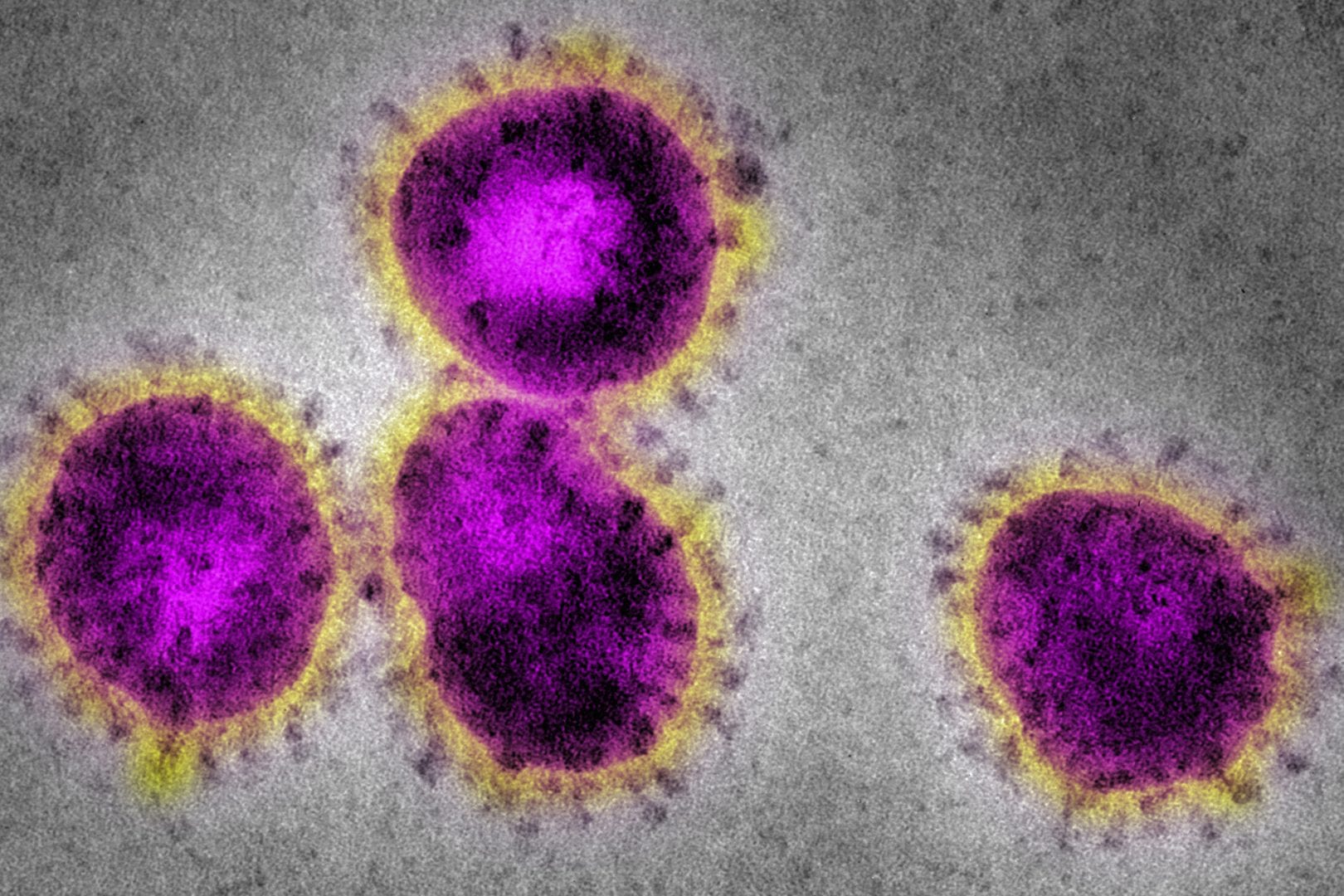 Coronavírus – O que é, quais suas causas e como surgiu