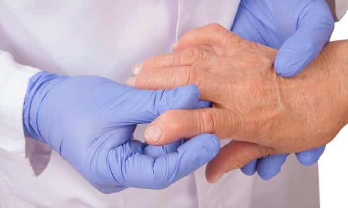 Reumatismo - o que é, principais causas e tratamentos indicados