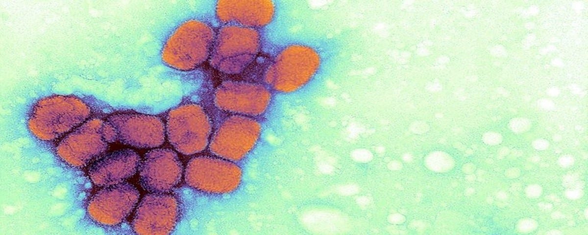 Varíola - O que é, sintomas, causas e tratamentos para essa doença