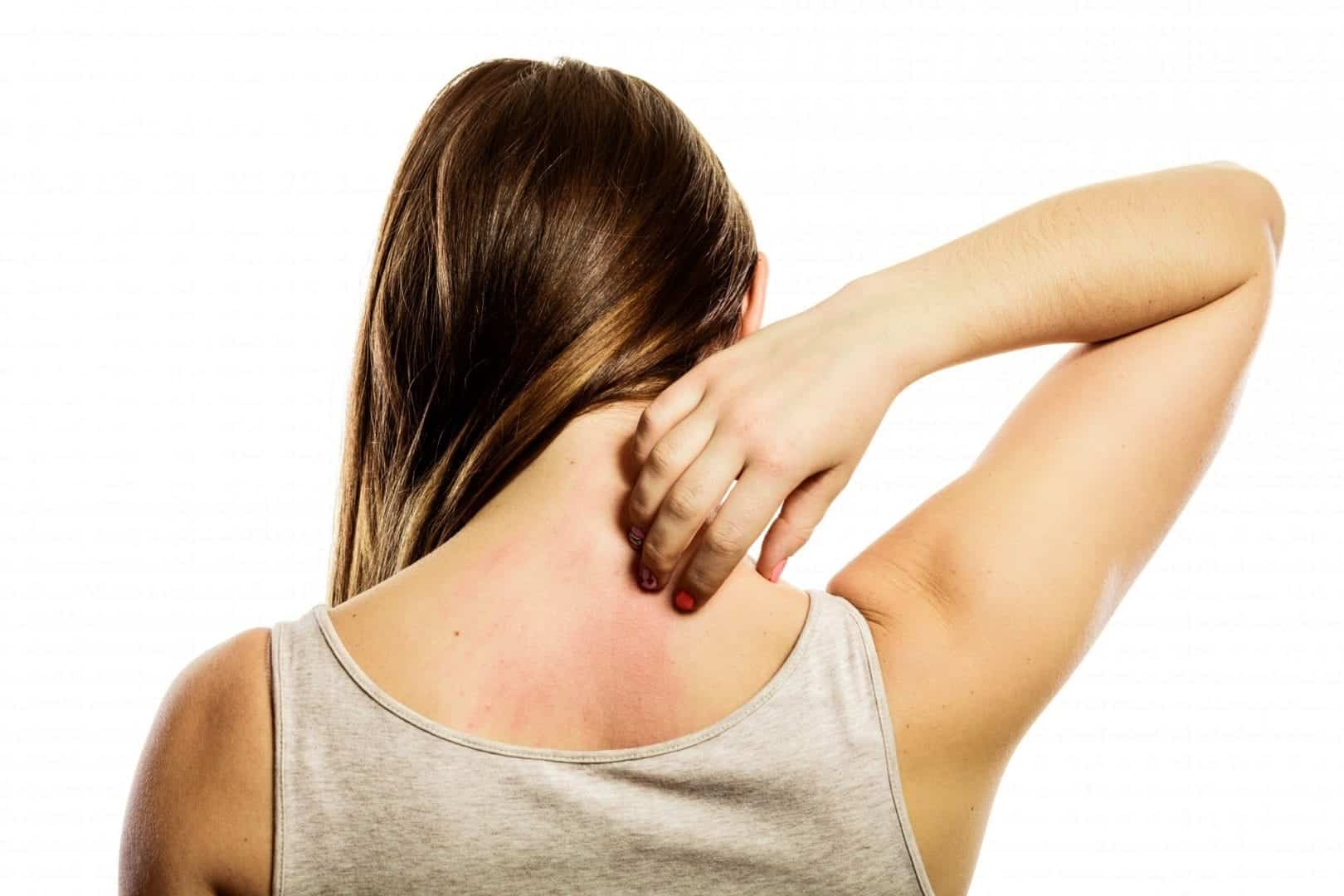 Alergias na pele - o que é, o que causa e como tratar