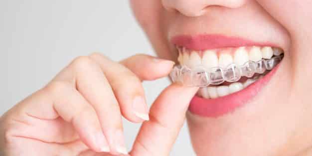 Dente separado - o que é, causas e principais tratamentos