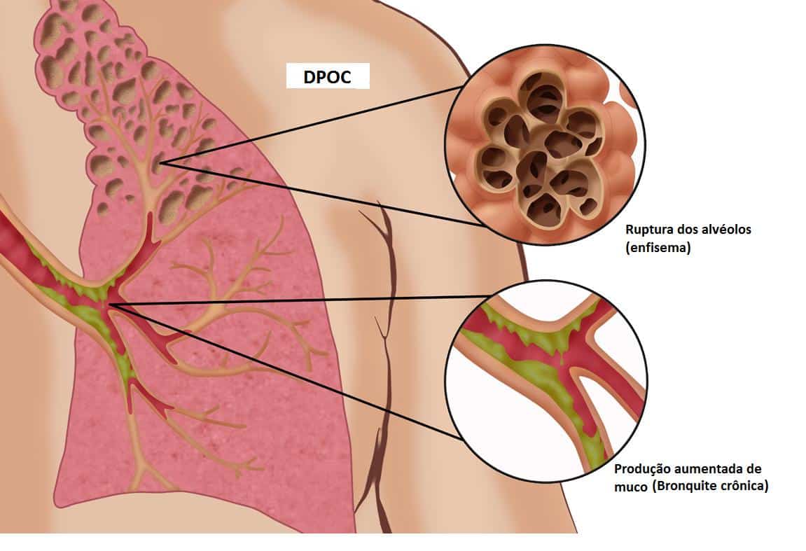 Função pulmonar em morsas - WeZooIt