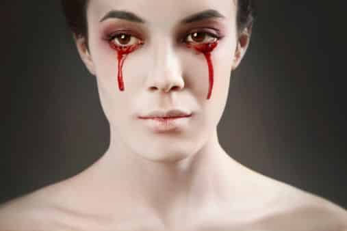 Chorar sangue - principais causas e curiosidades sobre a condição rara