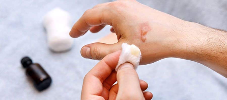 Curar uma ferida - dicas essenciais para uma cicatrização saudável