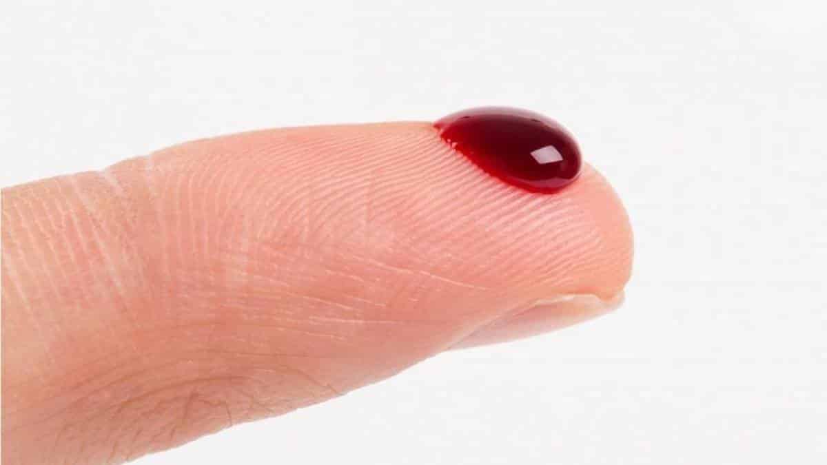 Medo de sangue - Por que acontece, sintomas e tratamento