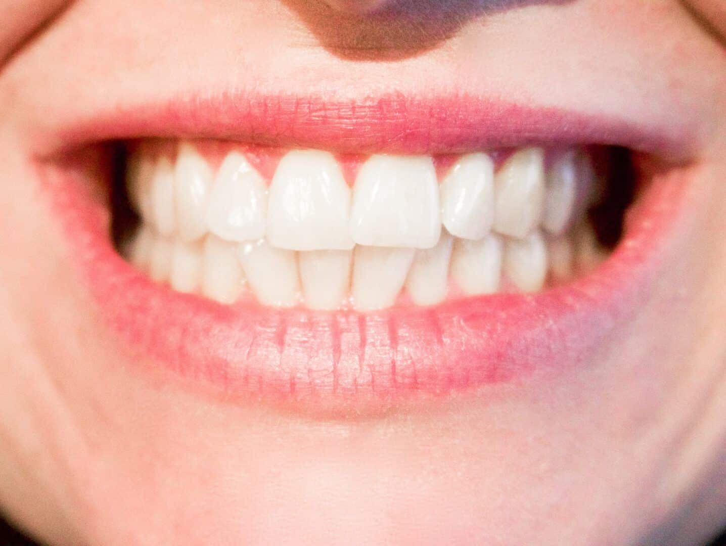 Quantos dentes temos? - diferença de quantidade entre crianças e adultos