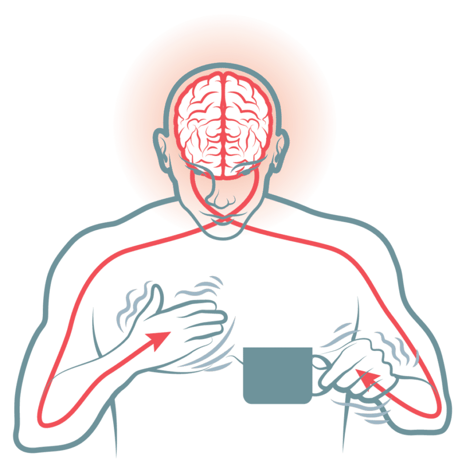 Tremores no corpo - Causas, tipos, sintomas e como tratar