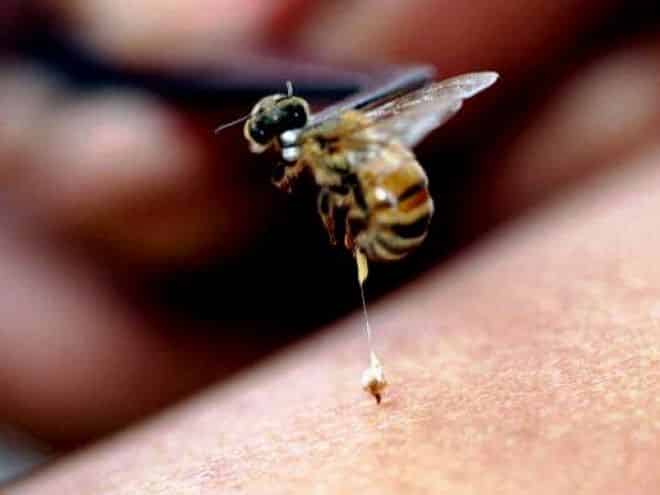 Picada de abelha - sintomas, riscos e o que fazer quando acontecer