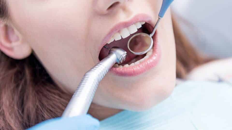 Fio dental - Como usar corretamente e quais os principais tipos