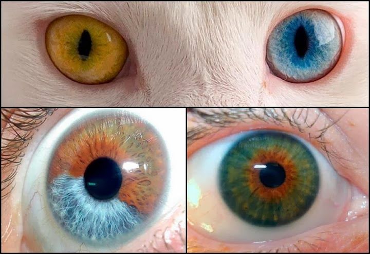 O que é heterocromia - características tipos e principais causas