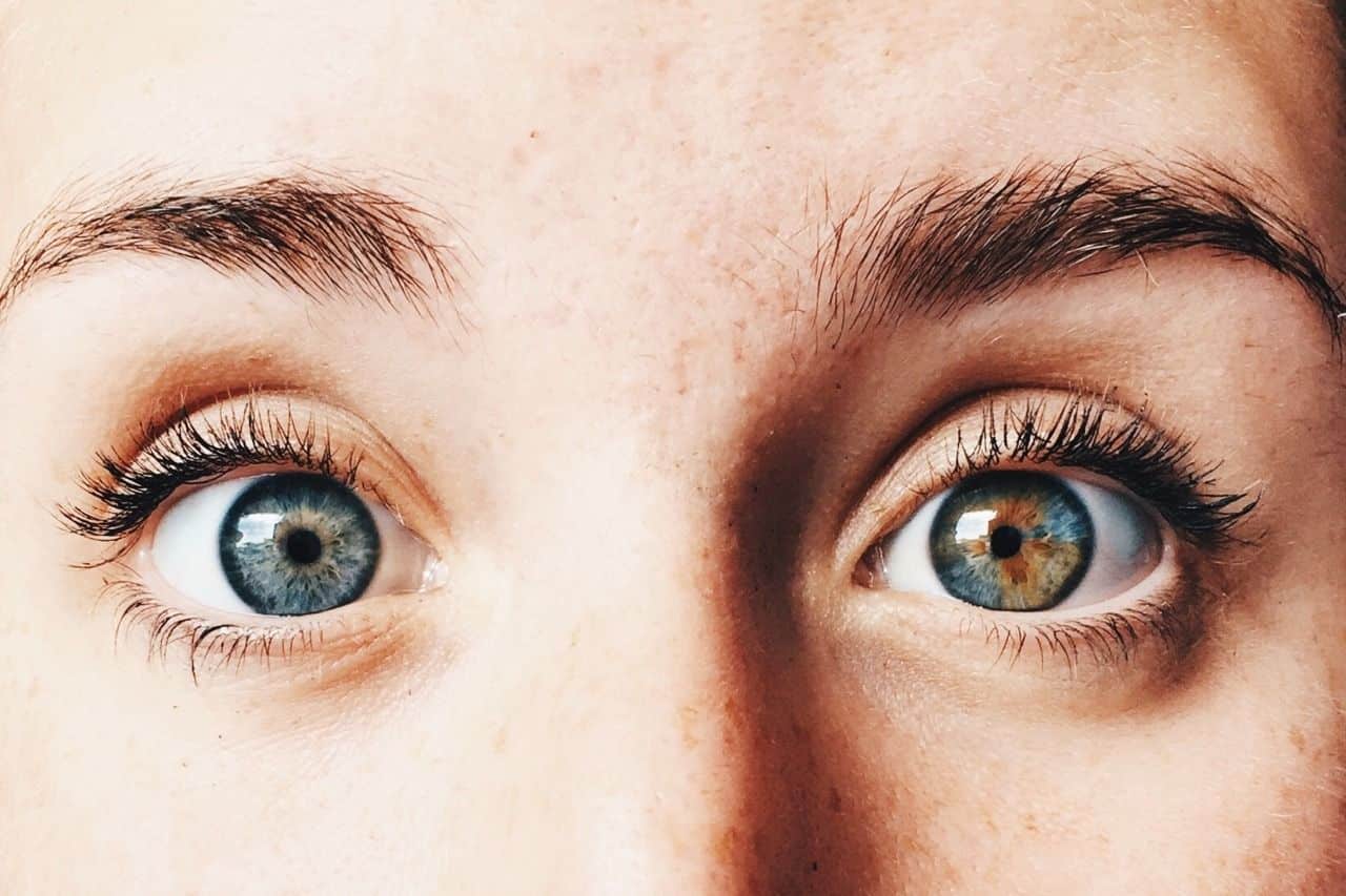 O que é heterocromia - características tipos e principais causas