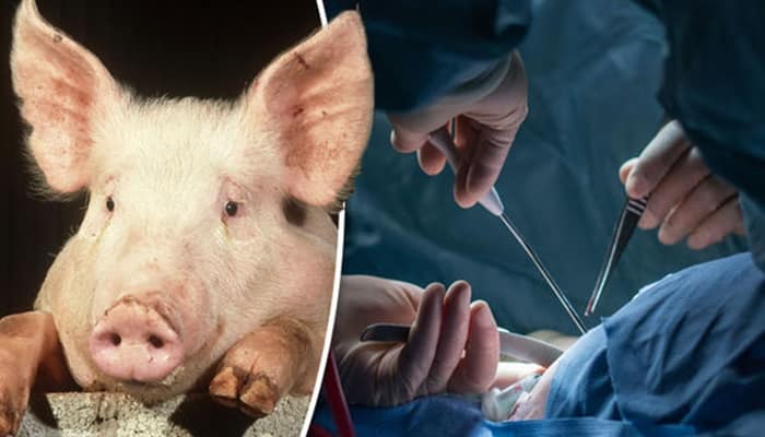 Entenda porque o 1º transplante de rim de porco em humano deu certo