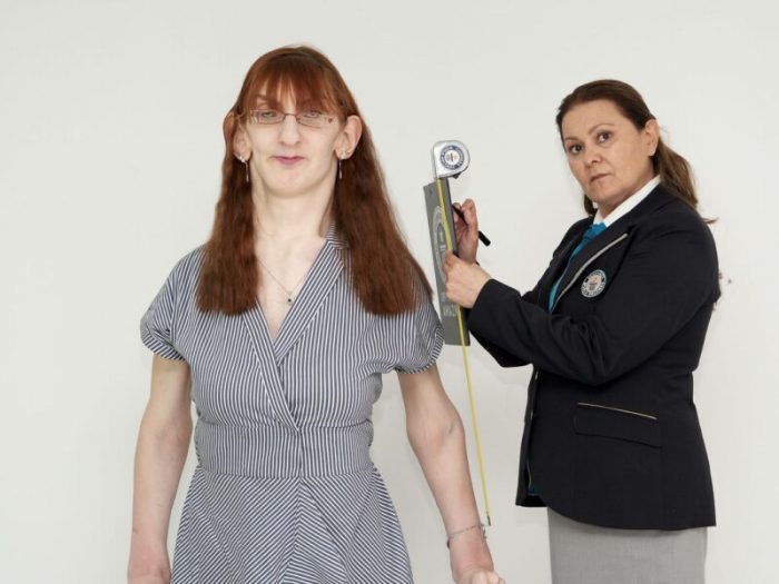 Rumeysa Gelgi: conheça a mulher mais alta do mundo e entenda a síndrome de Weaver