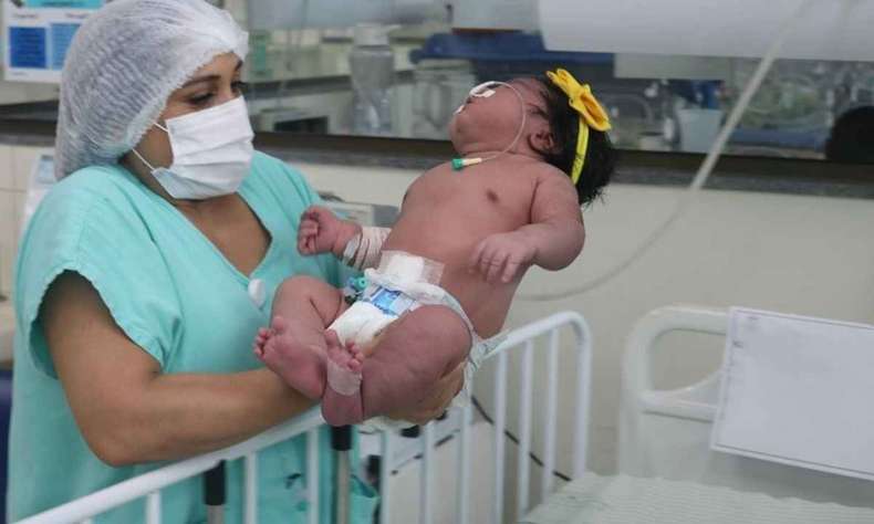 Criança de 7kg nasce no Pará e pode ser um dos 10 maiores do mundo