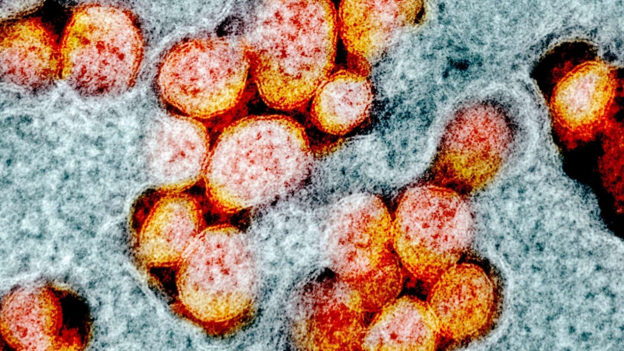 Próxima pandemia pode ser mais letal e mais contagiosa, segundo cientista