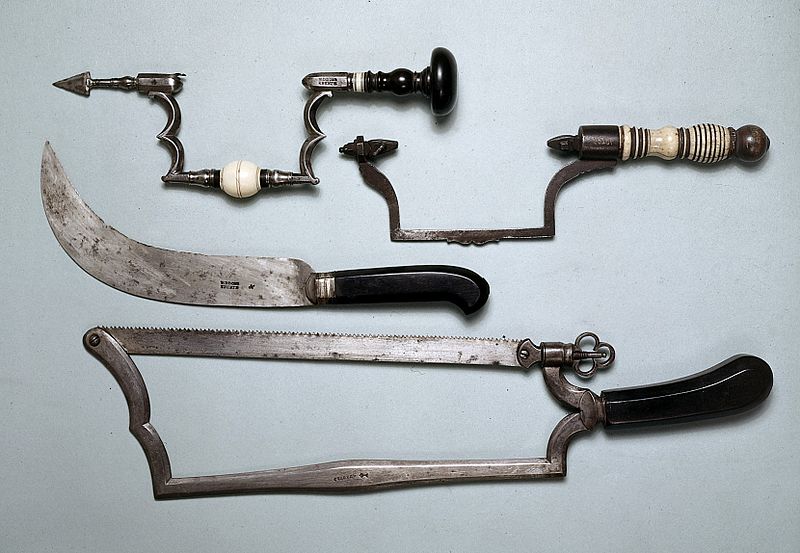 25 instrumentos médicos medievais bizarros e aterrorizantes